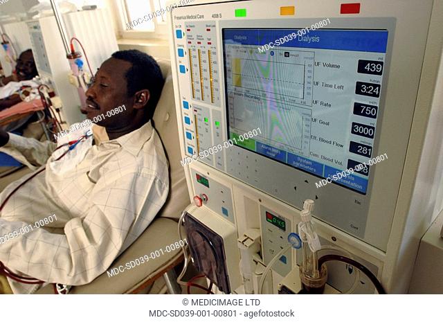 A man lays patiently while attached to a dialysis machine. The image shows the patient attached by Haemodialysis