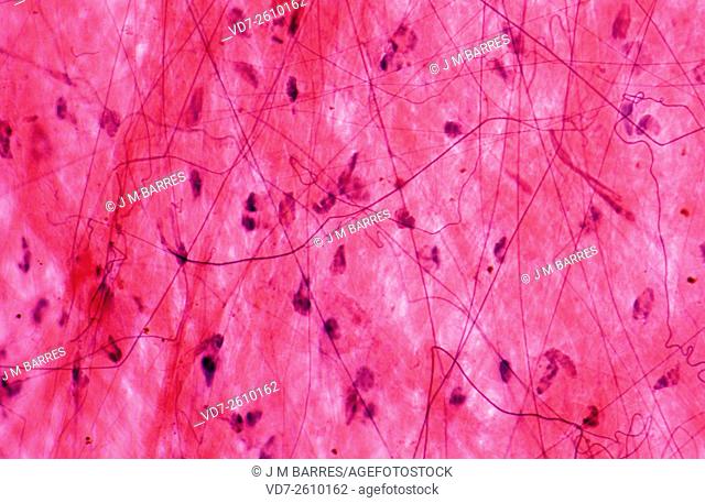 Loose connective tissue seen at light microscope X100. It is constituid for a gelatinous substance, collagen fibers, elastic fibers (elastin) and reticular...