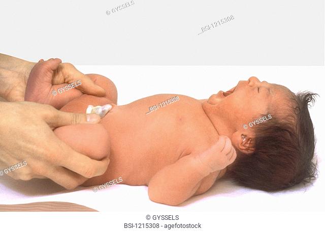 CONGENITAL HIP DISLOC., TEST Model. Lilas maternity hospital, France. Pediatric examination of the newborn baby. Screening test of the hip congenital...