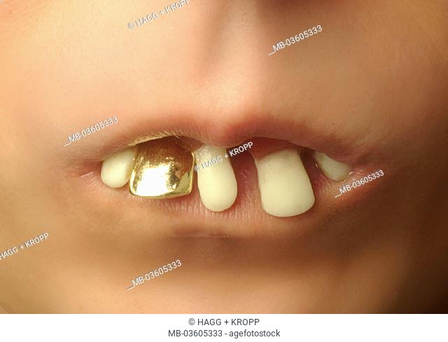 Child, mouth part, teeth, crooked