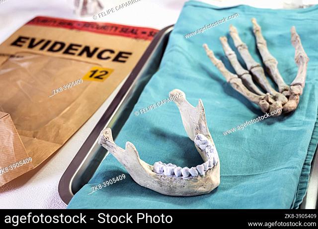 Human lower jaw and right hand in forensic laboratory murder investigation, concept image