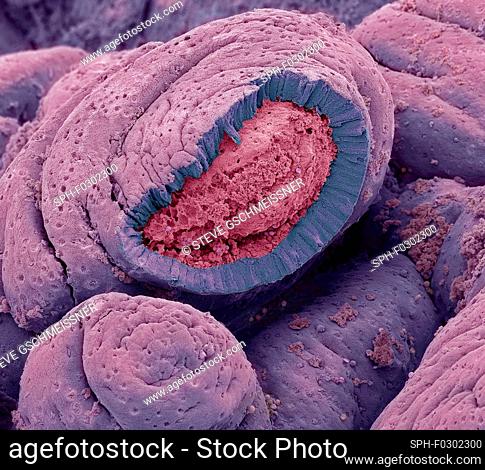 Small intestine. Coloured scanning electron micrograph (SEM) of a freeze-fractured of the small intestine. The surface consists of deep folds, called villi