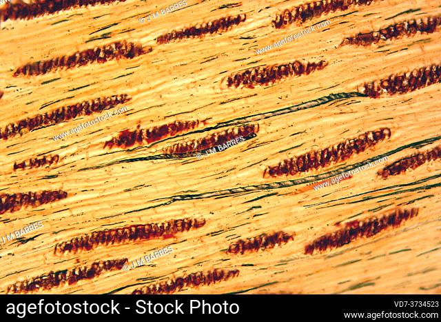 Xylem parenchyma or woody parenchyma. Photomicrograph X100 at 10 cm wide