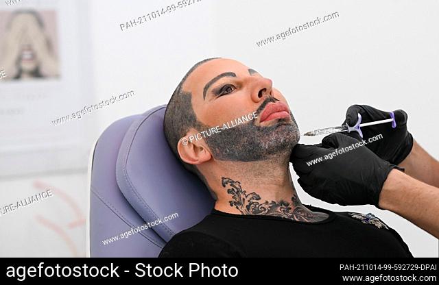 13 October 2021, Berlin: Fashion designer Harald Glööckler is having his cheeks injected at the Medicalthree cosmetic surgery clinic on Kurfürstendamm
