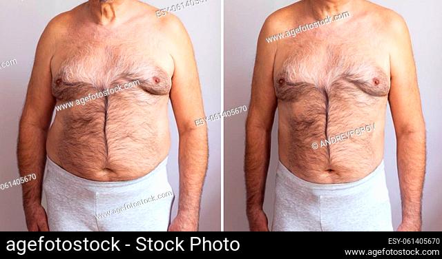 Portrait Of A Mature Man Before And After Weight Loss On White Background. Body shape was altered during retouching