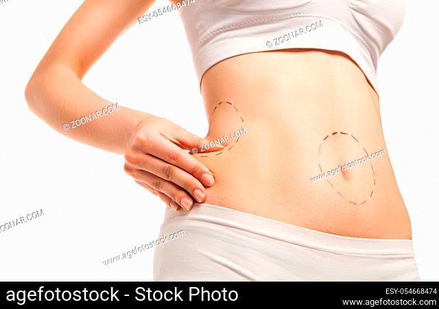Surgery outlines on woman#39;s body. Isolated over white background
