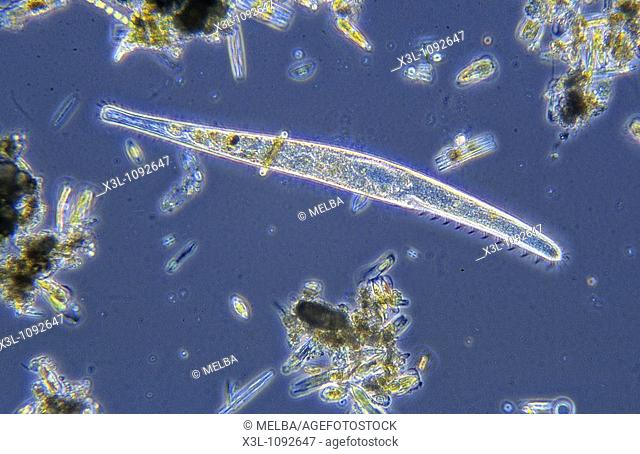 Spirostomum Ciliata Protozoans Optic microscopy