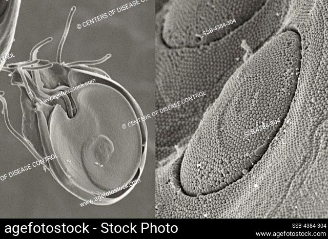 Giardia Protozoan's Ventral Adhesive Disk and Circular Lesion