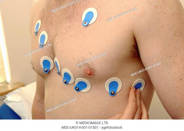 Close up of electrodes attached to a man's chest