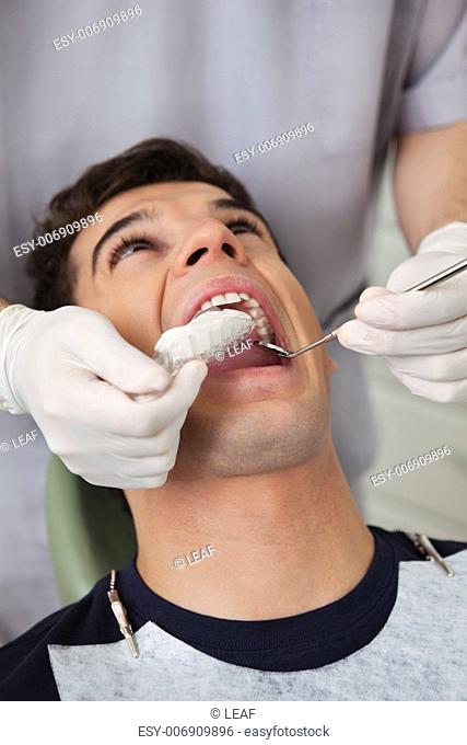 Dentist putting in molds in patients mouth