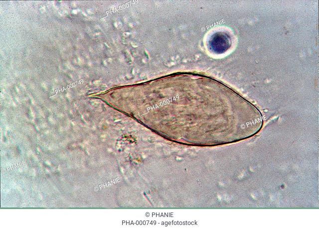 Light microscopy of Schistosoma intercalatum, a kind of trematode worm fluke, responsible for rectal schistosomiasis