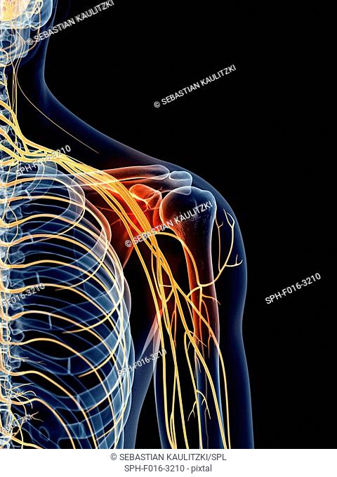 Shoulder nerve pain