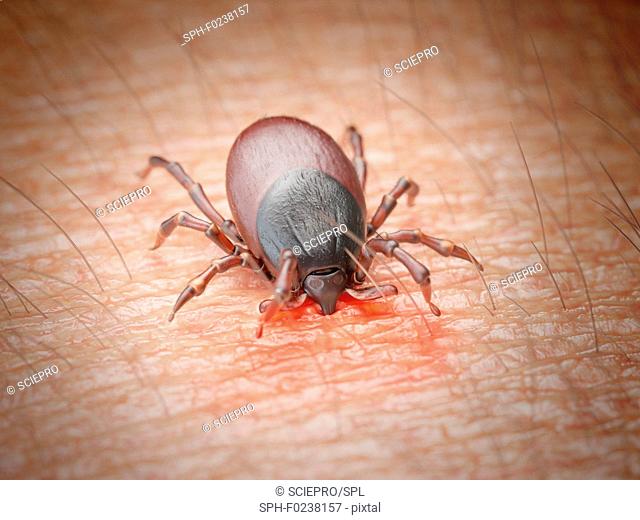 Illustration of a tick biting human skin