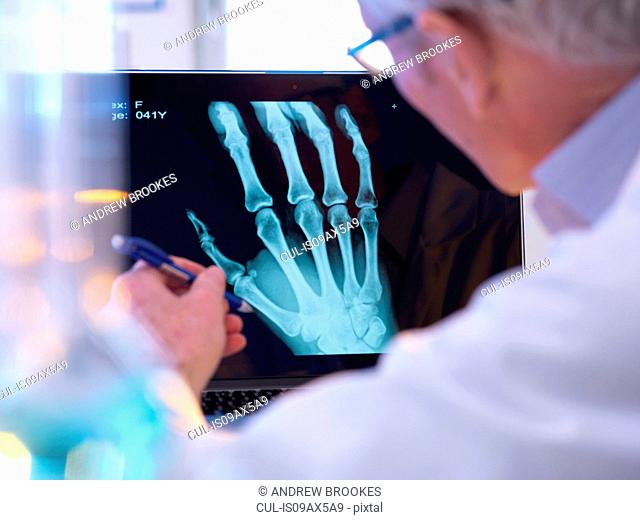Radiographer looking at x-ray of hand fracture
