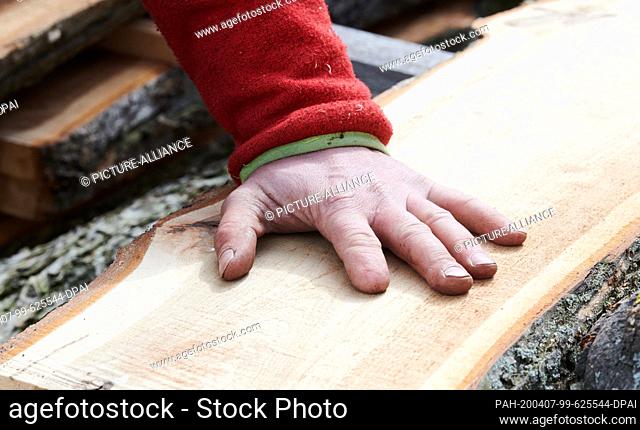 04 April 2020, Brandenburg, Märtensmühle: The index finger of the managing director of Lebens-Räume is significantly shorter and without a nail due to an...