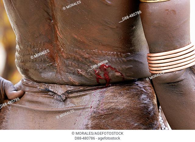 Body scars. Whipping ceremony. Girl Hamer tribe. Lower basin of Omo River. Ethiopia