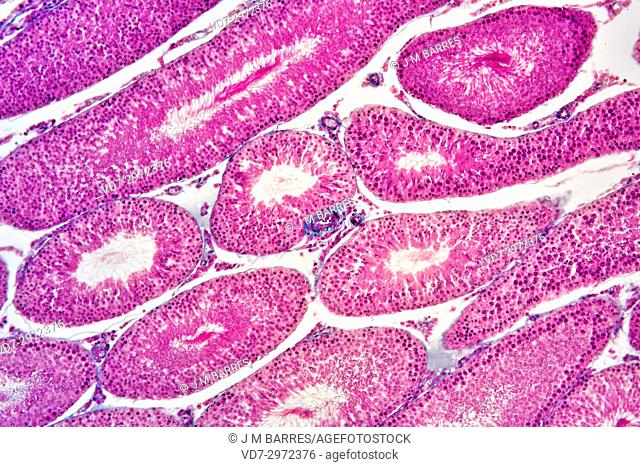 Human testicle or testis section showing seminiferous tubules, Leydig cells, Sertoli cells, spermatocytes, spermatogonia, spermatides and spermatozoon