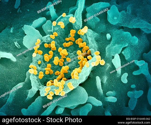 This scanning electron microscope image shows SARS-CoV-2 (round gold particles) emerging from the surface of a cell cultured in the laboratory