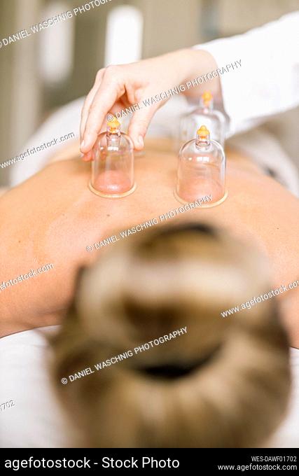 Cupping therapy, treatment at back