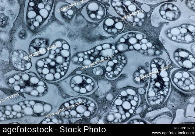 Starch in chloroplasts vegetal cell under electron microscopy