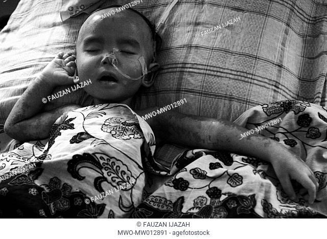 Darwis 2, a diarrhea patient under medical assistances in Zainoel Abidin Hospital The baby from Lampakuk village in Aceh Besar