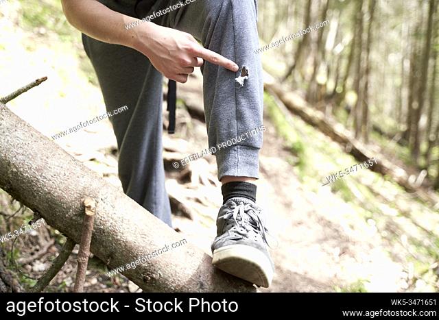 Young boy in forest, pointing at a rip on his trousers. Bad Tölz, Upper bavaria, Germany