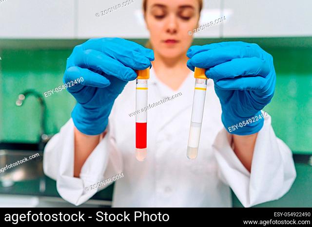 Female medical or scientific researcher holds in hands a test tube in a laboratory