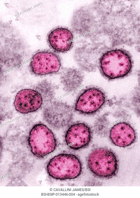Arenavirus. Arenaviruses cause several types of viral hemorrhagic fever (New World fevers). The viruses are transmitted to humans by rodents and bats