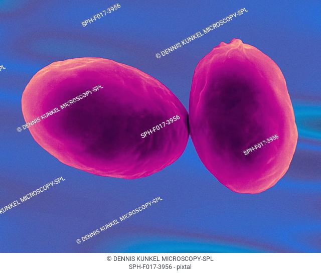 Giardia lamblia, a protozoan (cyst stage) found in water contaminated by animal faeces, coloured scanning electron micrograph (SEM)
