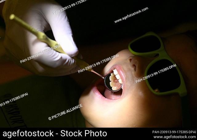 PRODUCTION - 11 September 2023, Lower Saxony, Hanover: A pediatric dentist examines a three-year-old child in a pediatric dental practice