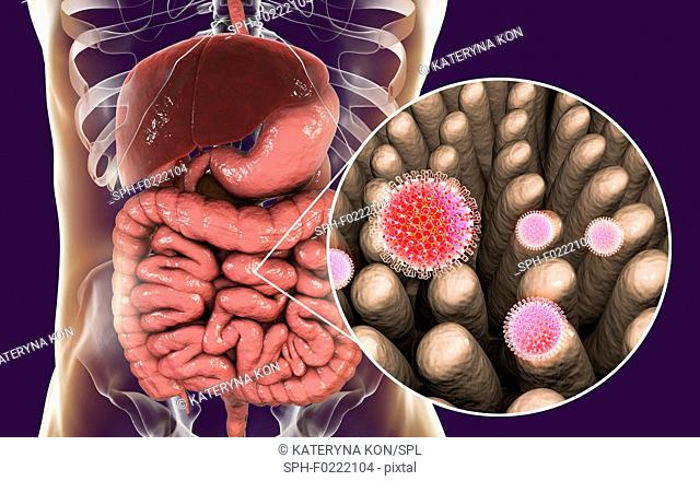 Rotaviruses infecting intestine, illustration