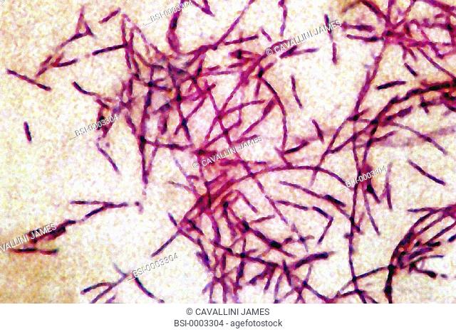 LEGIONELLA<BR>Legionella pneumophila, the bacteria responsible for Legionellosis or Legionaire's disease. Symptoms include pneumonia, flu-like symptoms