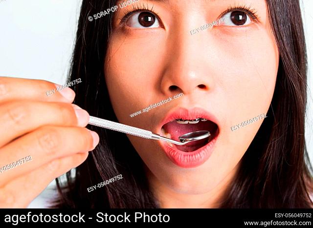 Asian teen beautiful young woman smile have dental braces on teeth laughing and have medical equipment tools for check tooth, isolated on a white background