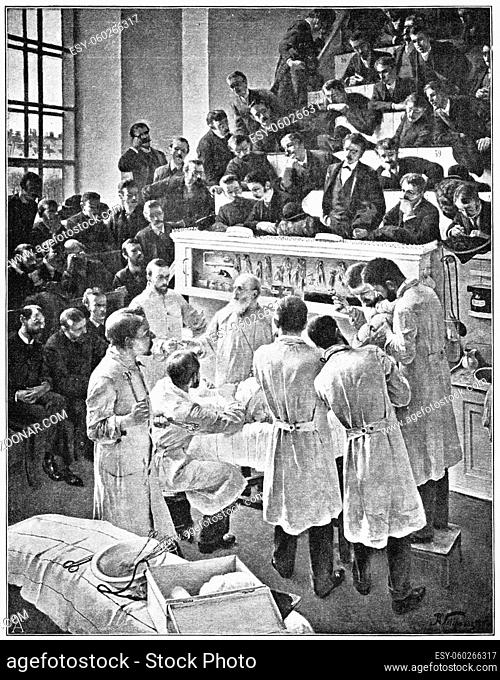 The German surgeon Theodor Billroth operating in the auditorium of Vienna General Hospital (Allgemeine Krankenhaus). Illustration of the 19th century