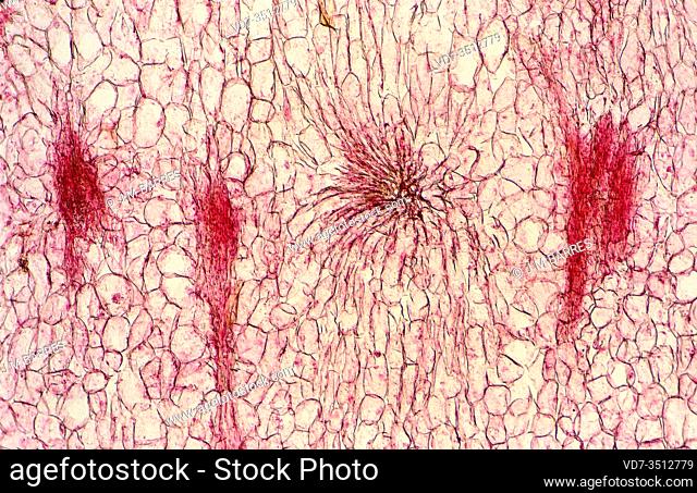 Sclerenchyma is a support tissue with lignified cellular walls. Photomicrograph