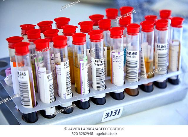 Blood samples, Hematology, Hospital Donostia, San Sebastian, Gipuzkoa, Basque Country, Spain