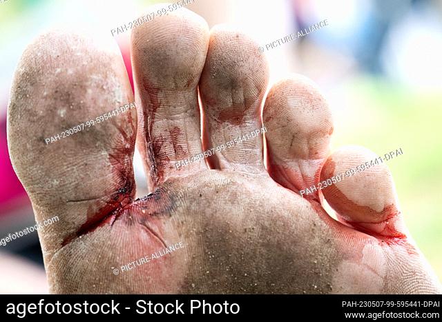 07 May 2023, Rhineland-Palatinate, Mainz: Blood and dirt collect between the toes of a runner who ran the half marathon barefoot after the 21st Gutenberg...