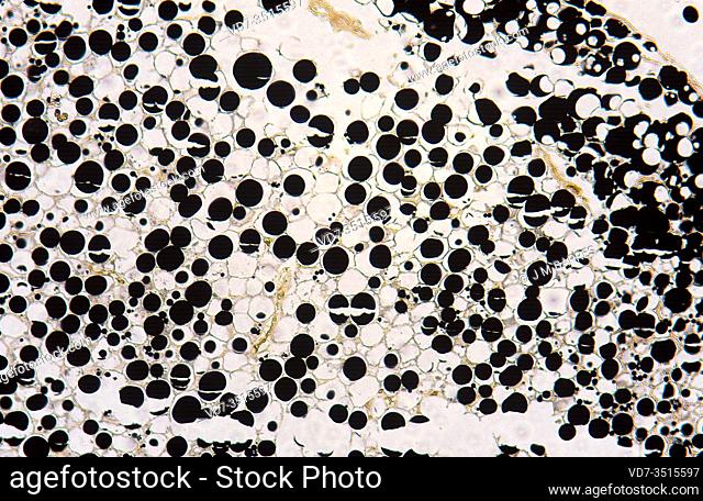 Adipose tissue osmium tetroxide stained. Photomicrograph