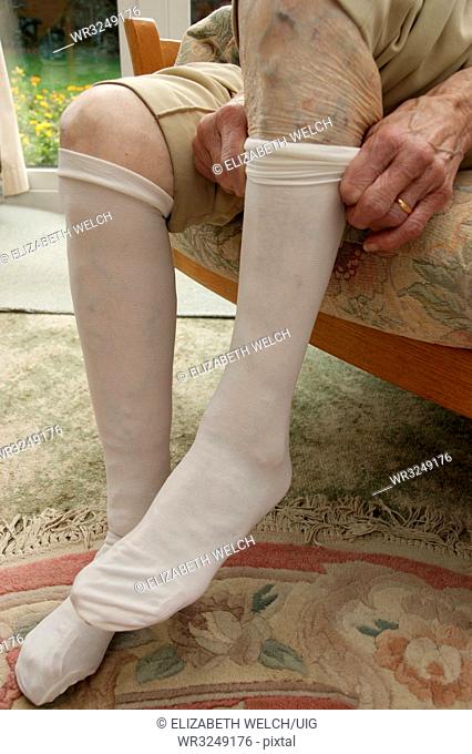 Elderly woman putting on compression support stockings
