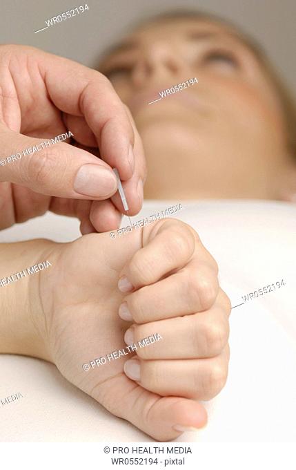 Acupuncture on the back of the hand - EX - UE 7
