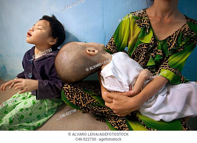Children severily deformed from exposure to food and water contaminated with the toxic chemical Agent Orange, Ben Tree. Vietnam