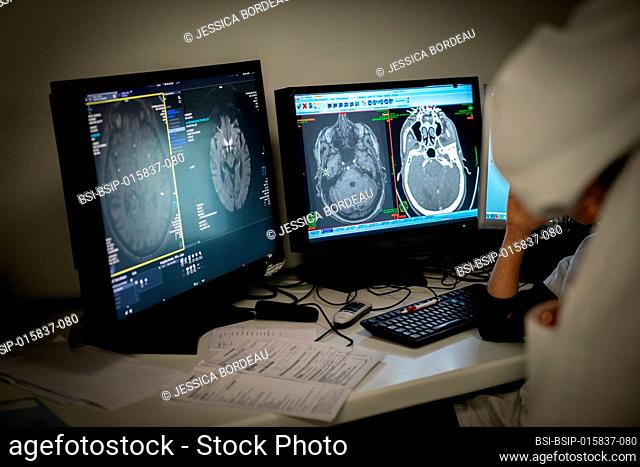 A 77-year-old patient with signs of stroke is managed. Following the MRI, the neurologist hesitates on the procedure to follow and consults his colleague
