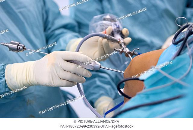 19 July 2018, Germany, Munich: A doctor operating on a patient's knee in the Orthopedic Surgical Ward Munich (OCM). The patient was outfitted with a replacement...