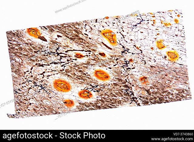 Epithelium simple squamous. Photomicrograph X75 at 10 cm wide