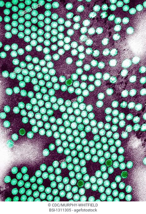POLIOMYELITIS VIRUS<BR>Electron micrograph of the poliovirus.  Poliovirus is a species of Enterovirus, which is a Genus in the family of Picornaviridae