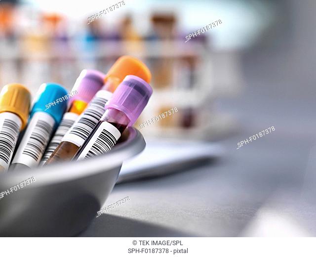 Tray of human medical samples awaiting clinical testing in a laboratory