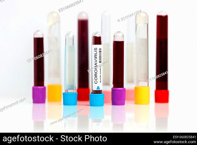 Testing the laboratory sample of the novel Coronavirus
