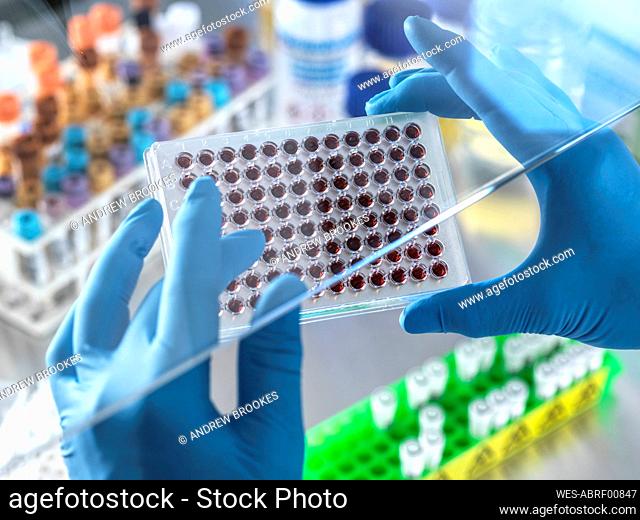 Male scientist's hands with blood samples in multi well plate at laboratory