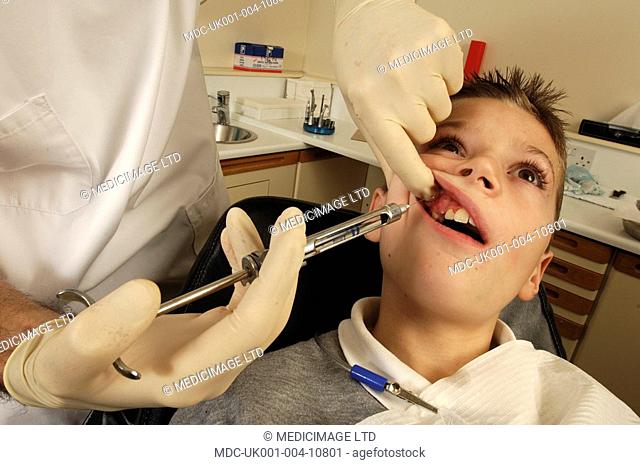 Dentist injects a local anaesthetic into the gums of his patient