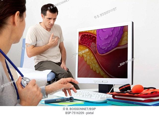 CARDIOLOGY CONSULTATION MAN Models. On screen, drawing representing an artery obstructed following a stenosis caused by the compression of the tumor